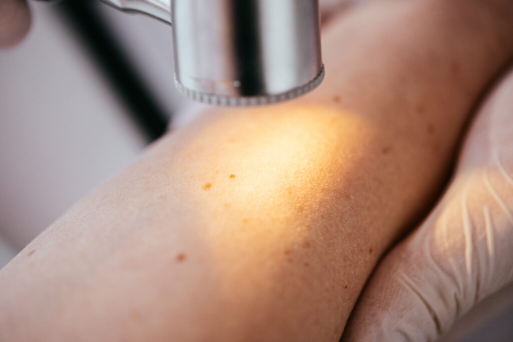 Lasermedizin und lichtgestützte Therapie der Haut